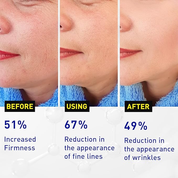 Vitamin C Face Serum for Anti Aging: Enaskin Naturals Super C Serum with Ferulic Acid for Women Mature Skin, Premium Formula Vit C Facial Serum for Brightening Dark Spots and Glowing up Skin - 1.7 Oz