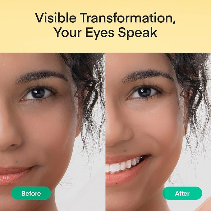 Vitamin C Niacinamide Eye Patches: Brightening & Glowing Under Eye Mask with Tranexamic Acid Caffeine Hyaluronic Acid - Korean Skin Care Dark Circles Puffiness & Wrinkles Hydrogel Treatment, 60 Pcs