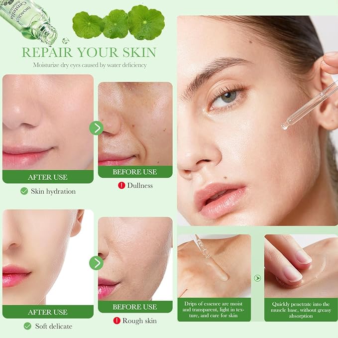 BIOAQUA Centella Asiatica Soothing Repair Facial Serum Nourish Oil Control Anti-Acne Face Skin Care 30ml / 1fl.oz