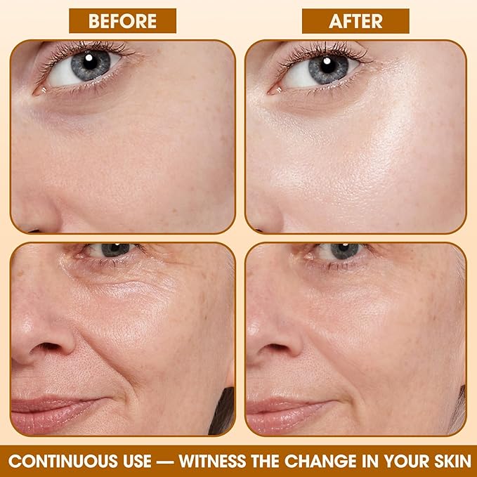 24K Gold Collagen Infusion Face Mask, Layered Patch Mask, Deep Hydrating Moisturizing Collagen Facial Mask, Women's Skin Care, No-Cleaning Sleeping Face Mask (Package of 4)