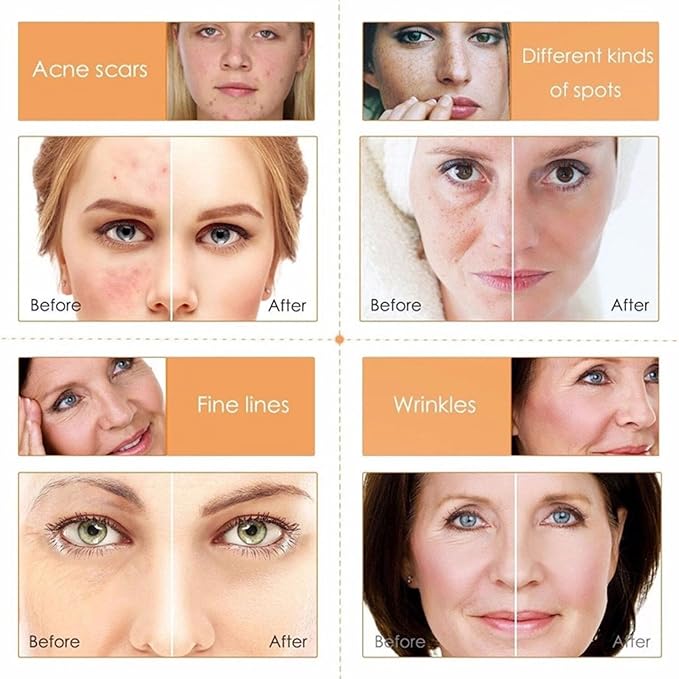 8-Pack Vitamin C Skin Care Kit, Vitamin C Complete Skin Care Set, Routine Skincare Set With Face Wash, Toner, Face Serum, Face Cream, Eye Cream, Face Mask & Lip Balm, Skincare Gift Set For Women