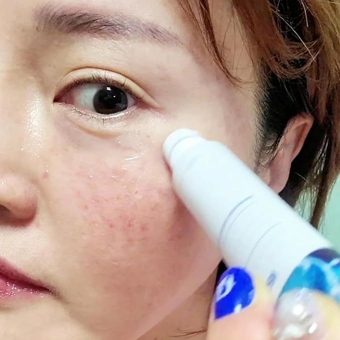 Farmstay Collagen Water Full Moist Rolling Eye Serum - Under Eye Serum Reduces Wrinkles and Fine Lines - Skincare Product with Shea Butter - 0.84 oz