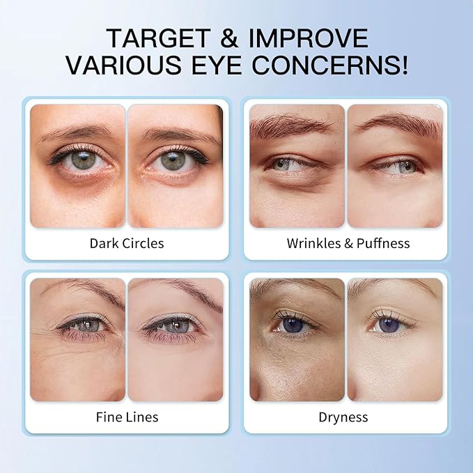 Eye Serum with 5% Caffeine & 5% Retinol for Dark Circles, Puffiness Puffy Bags & Wrinkles Fine Lines - Under Eye Cream Anti Aging Treatment with 360° Massage Roller Ball for Men & Women