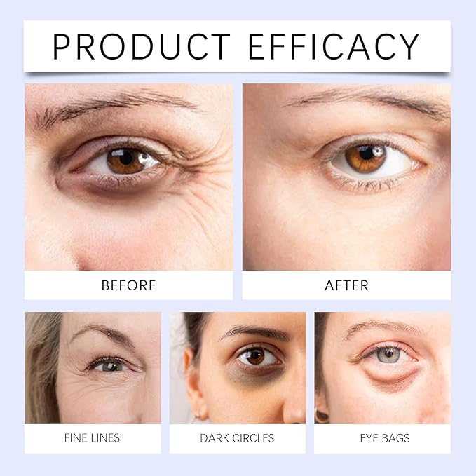 Coffee Beef Tallow Eye Cream for Dark Circles, Beef Tallow for Skin,Organic Grass Fed Beef Tallow Eye Cream, Rapid Wrinkle Repair, Daily Anti-Aging Under Eye Cream, Tired Eyes, Fragrance Free,