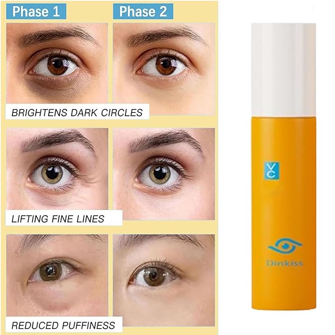 Dinkiss Lutein Eye Essence Oil, Vitamin C Lutein Eye Essence Oil, Improve Bags and Dark Circles, for Women Men (1, 3 pcs)