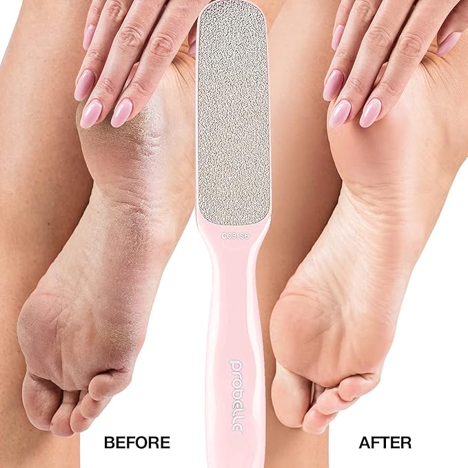 Probelle Double Sided Multidirectional Nickel Foot File Callus Remover - Immediately Reduces calluses and Corns to Powder for Instant Results, Safe Tool (Pink)