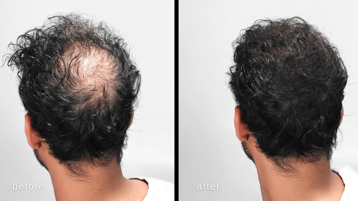 LUXE Hair Building Fibers - Thickening Fibers - CONFIDENCE IN A JAR – 2 Months+ Supply! – Hypoallergenic, Dermatologist Tested – Multiple Colors Available (Medium Blond)