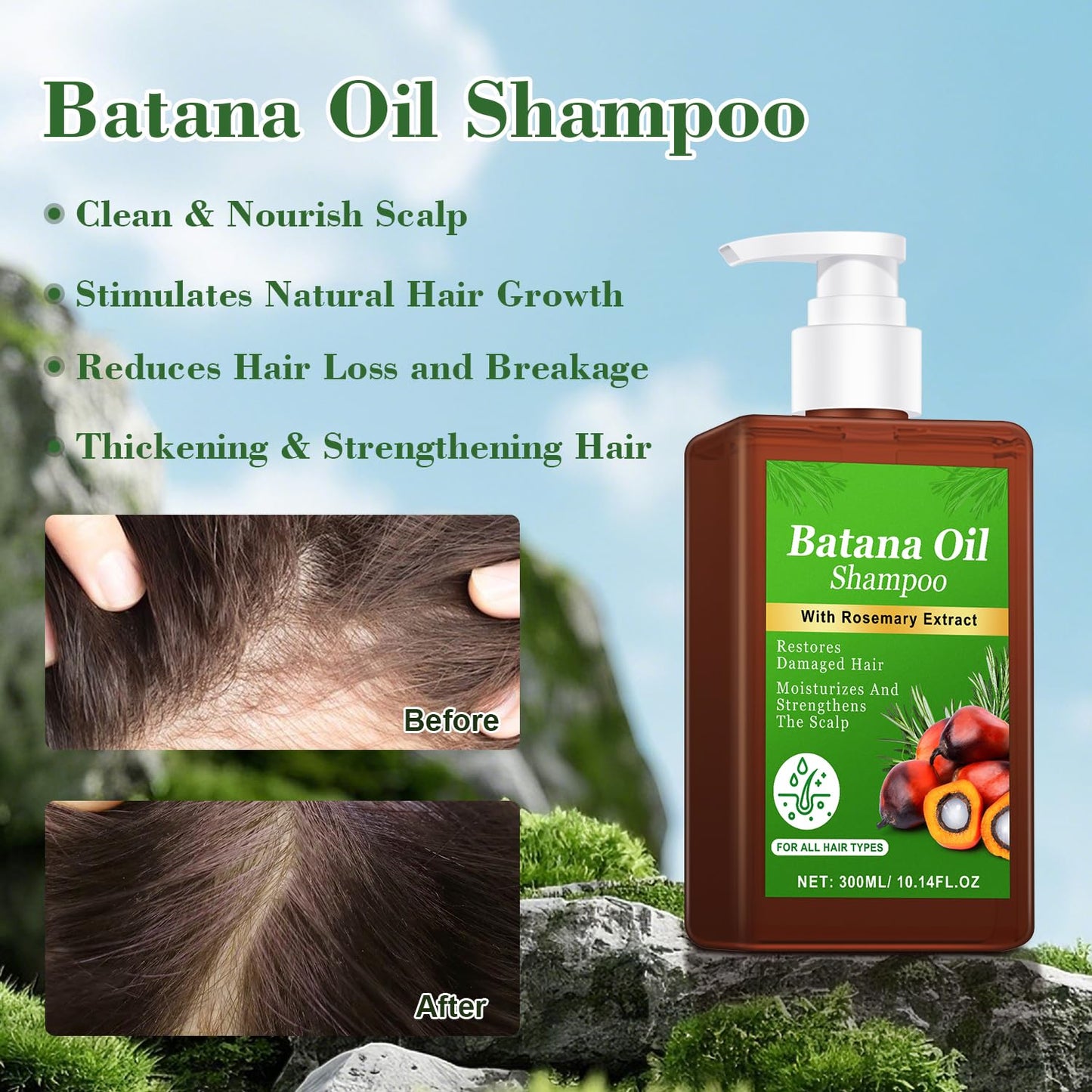 -Promote Hair Growth,Rosemary Shampoo,Nourishes Scalp, Reduces Breakage & Adds Shine,Reduces Hair Loss (Batana Shampoo-(10.1 fl oz))