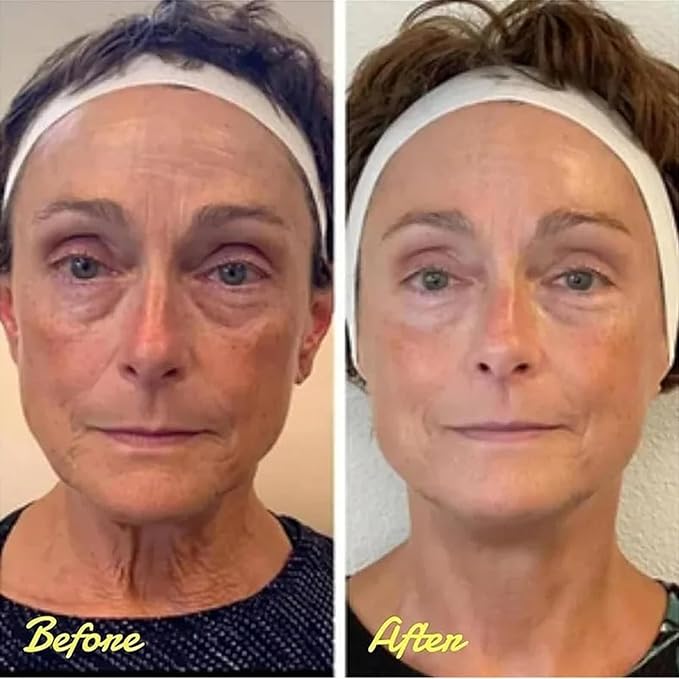 Instant Eye Tightener Cream,Under Eye Tightening Cream for Firm and Smooth the Look of Fine Lines,Reduces Dark Circles, Bags, Puffiness and Fine Lines,Instant Firm Face Tightener(30ml)