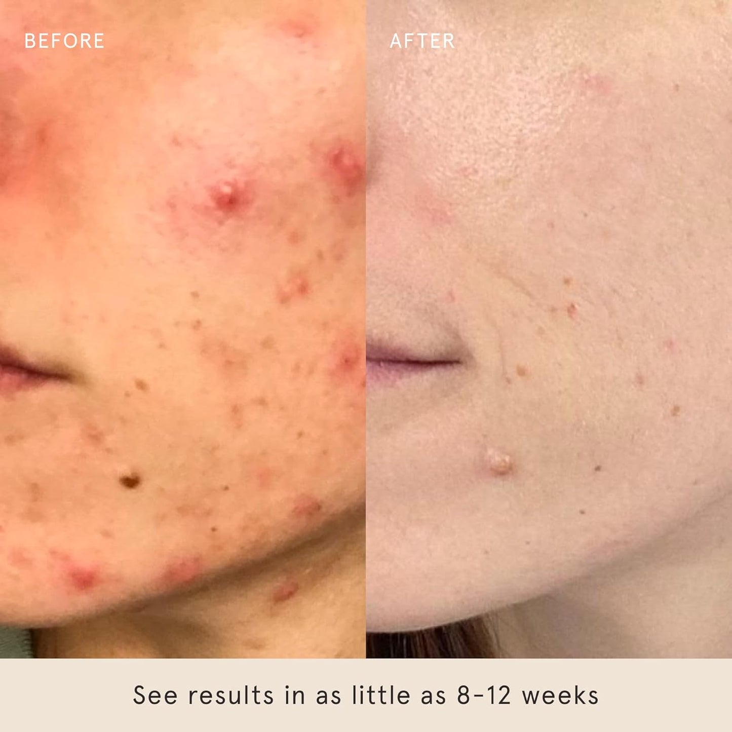 Barefaced Core Four (Retinoid Alternative) - Toning Pads II, Liquid Gold, Overachiever, Tinted SPF