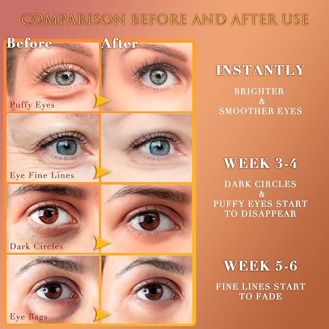 24K GOLD Eye Mask– 60 Pcs - Gold Under Eye Mask Retinol & Collagen - Puffy Eyes and Dark Circles Treatments – Look Younger and Reduce Wrinkles and Fine Lines Undereye, Improve and Firm eye Skin