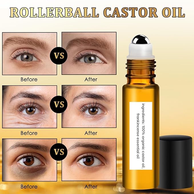 2 PCS Eye Essence Oil Roller Ball Applicator,Castor Frankincense Rollerball, Frankincense and Castor Oil Roller for Eyes, Bags Under Eyes