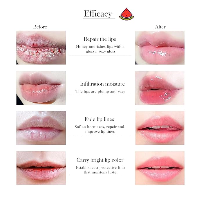 8 PCS Bee Lip Balm Honey Pot - Strawberry, Watermelon, Apple Lime, Cherry, Mint, Grapes & Peach Flavors - Sleeping Mask for Hydrating & Preventing Dry, Cracked Lips