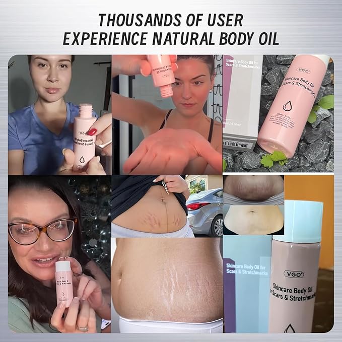 VGO Body Oil with Vitamin E, After Shower Body Oil For Smooth and Hydrated Skin, Non-Greasy & Fast Absorbing Lightweight Moisturizer for Scars & Stretch Marks, Hydrating for Dry Sensitive Skin