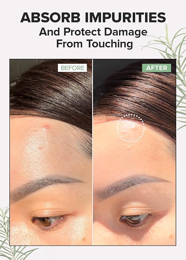 I DEW CARE Emergency Skin Care Kit - Ready Aim Clear + Skin Care Set - Kitten My Balance On | Travel Size Trio Bundle