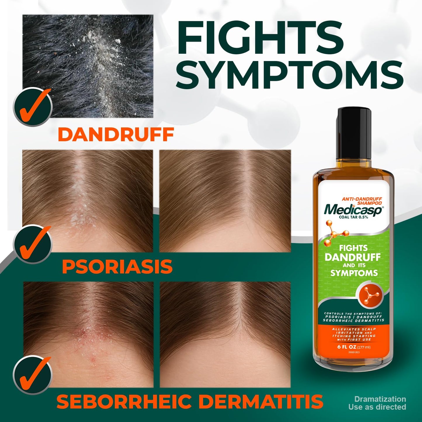 Medicasp Anti-Dandruff Shampoo and Massager Kit – Coal Tar for Dandruff, Psoriasis, and Seborrheic Dermatitis, Scalp Massager Brush for Exfoliation and Care, 6 fl oz