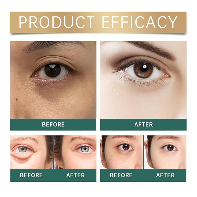 Under Eye Masks，Golden Cucumber Eye Mask 60 Tablets Set，Eye Mask for Fine Lines, Wrinkles, Dark Circles and Eye Puffiness，Suitable for Both Men and Women，5.64 OZ