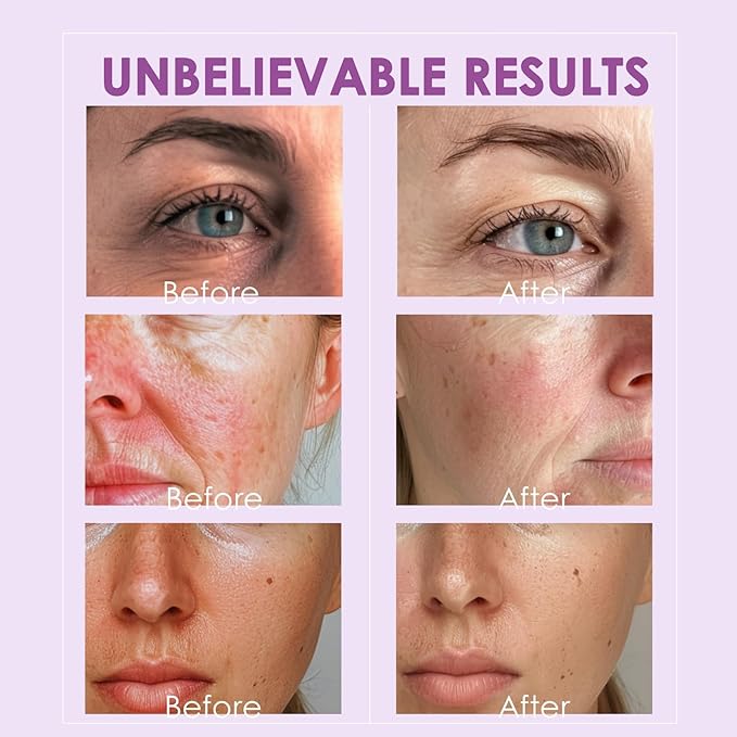 Facial Ice Globes Cryo Stick, Cooling Roller for Face, Neck & Eyes, Beauty Tool to Refresh Skin, Smooth Fine Lines, Reduce Puffiness, Tighten Pores, Skincare Gift Set, Glitter Purple