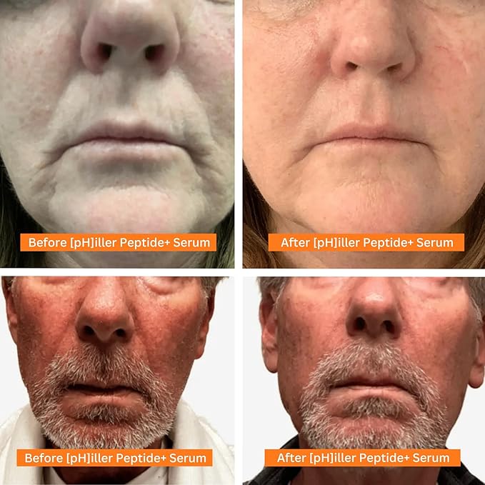 pHiller Peptide Serum - Advanced Anti Aging Face Tightening Serum for Fine Lines and Wrinkles, Hydrating Peptides Facial Formula for Skin, with Argireline + Tripeptides; Vegan (1oz)