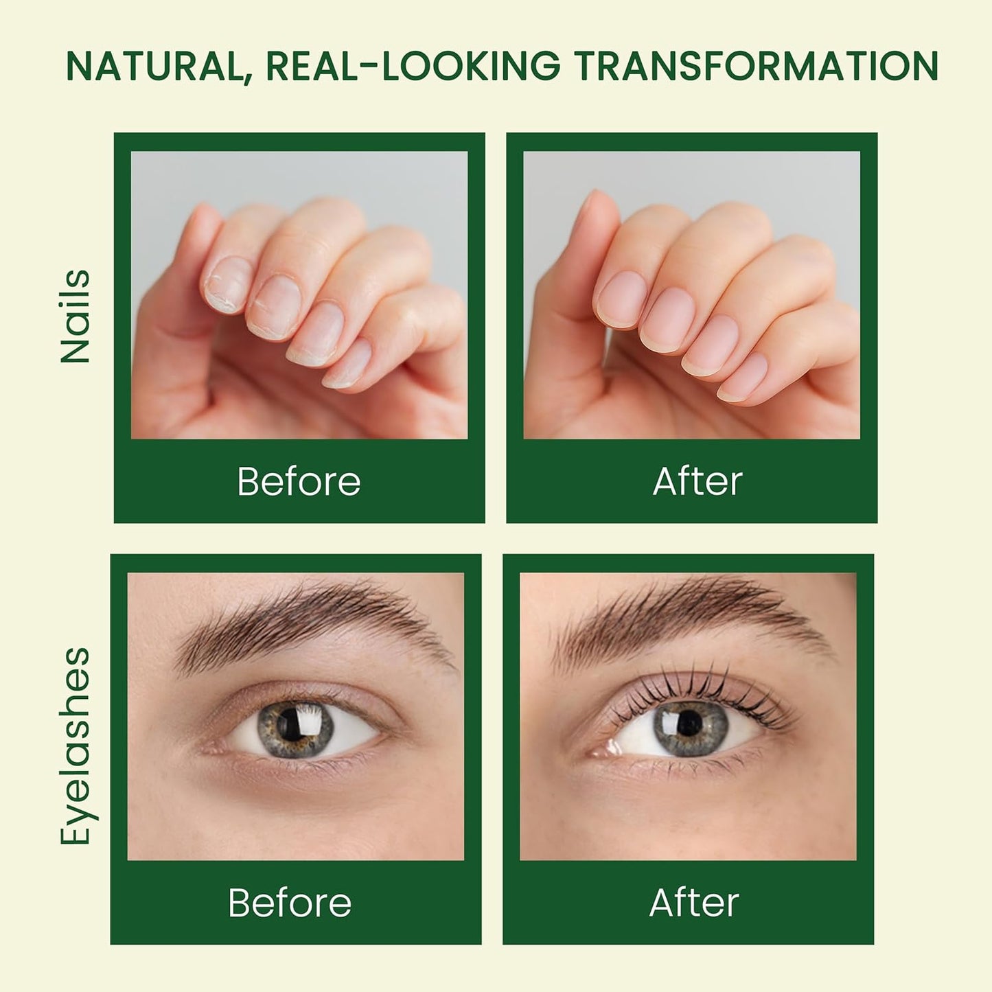 Pure Castor Oil - Cold Pressed 100% Castor Oil for Hair Growth, Skin, Eyebrows, Eye Lashes, Nails & Cuticles - Hexane Free, Natural & Unrefined - Includes Dual Mascara, Dropper & Scalp Massager