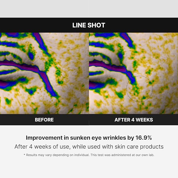 Medicube Age-R Line Shot - A Start of Effective Fine Lines Care Device for Smoothing Wrinkles Around Eyes, Lips, 11s, Neck, Plump Lips - Daily Anti-Aging Treament - Korean Skin Care