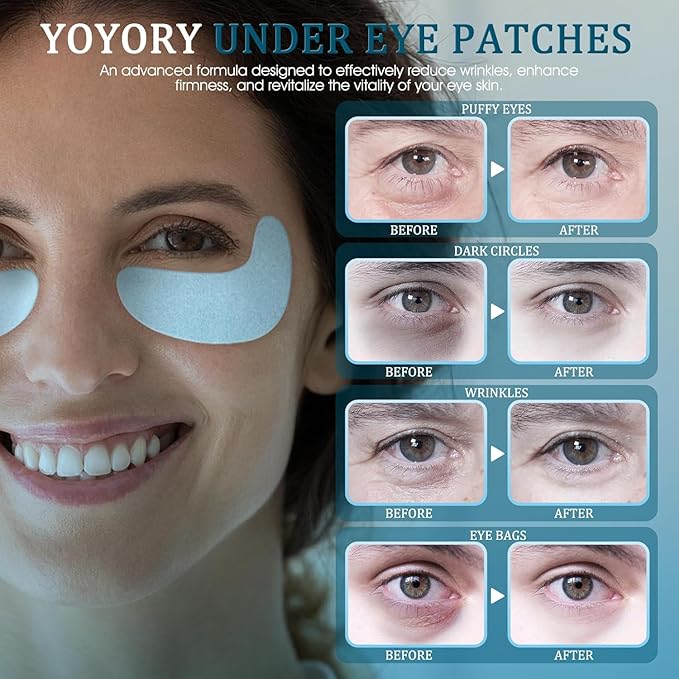 Under Eye Patches Masks - for Dark Circles, Puffiness, Wrinkles & Fine Lines 30 Pcs Moisturizing Patches with Hyaluronic Acid,White