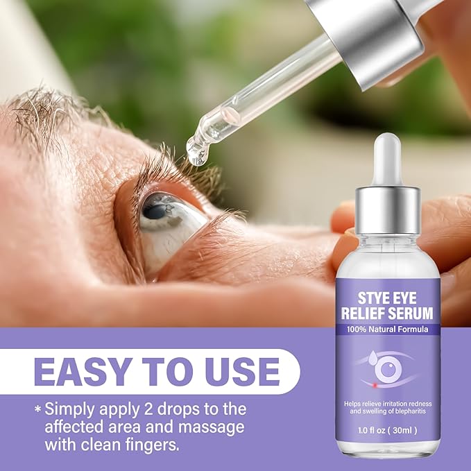 Stye Eye Treatment, Natural Stye Relief Serum, Gently Cleanses Lashes and Eyes, Chalazion and Blepharitis Treatment，Relieves Eye Irritation