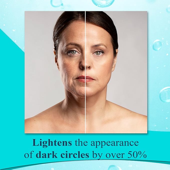 Elite Serum Rx - Anti Aging Under Eye Serum for Dark Circles and Puffiness with 7 Patented Peptides - Extra Strength Eye Lifting and Firming Serum for Wrinkle Repair and Eye Bags Treatment