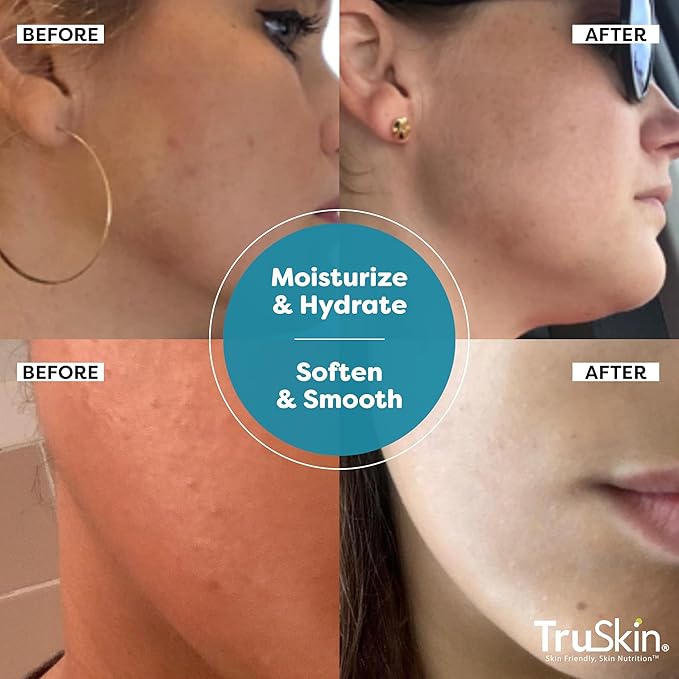 TruSkin Hyaluronic Acid Serum for Face + 7 Ultra Hydrating Ingredients – Best Face Serum for Moisturizing, Visibly Plumping Skin & Smoothing the Look of Fine Lines, 1 fl oz