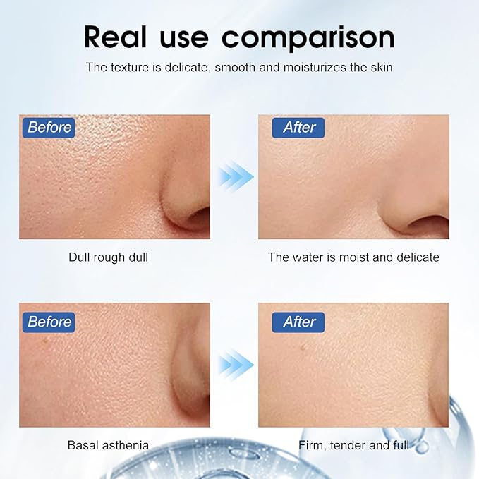 Made in Germany Premium Hyaluronic Acid Serum for Skin Pure Anti Aging Serum Intense Hydration Moisture Non greasy Paraben free, Wrinkle Reducing and Brightening Serum-Hydrating （2 boxes） (2 boxes)