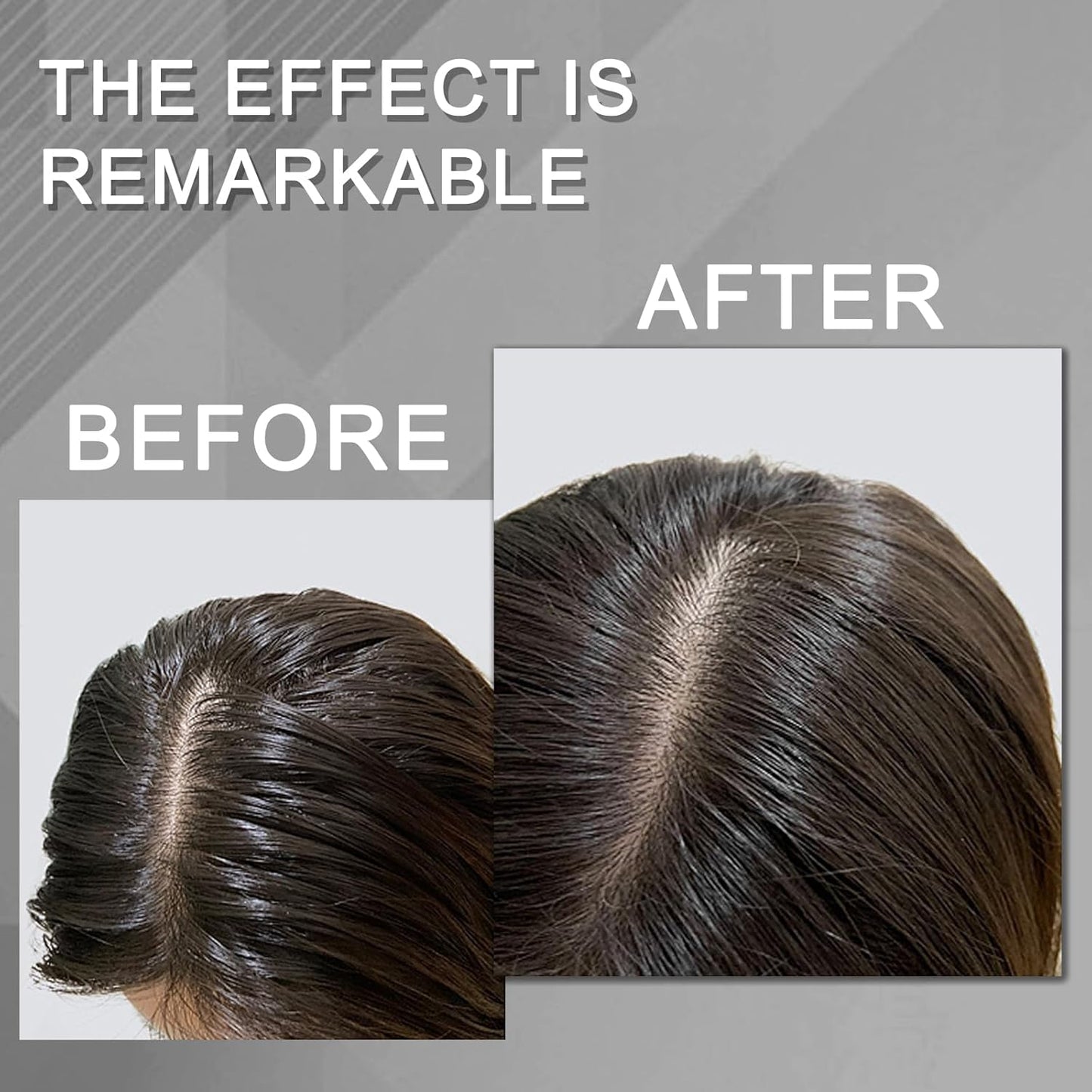 BENIX Dry Shampoo for Women & Men- Volumizing Spray for All Hair | Invisible Formula, Instantly Fresh & No White Residue | Natural Dry Shampoo Powder with Rice Starch (5 Oz)