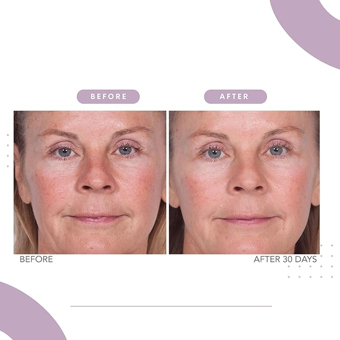 Serious Skincare Reverse Lift Trio Skin Firming Set - Tighten, Lift and Sculpt Face, Chin and Neck - Peptides - Hydrolyed Collagen - (3pack)