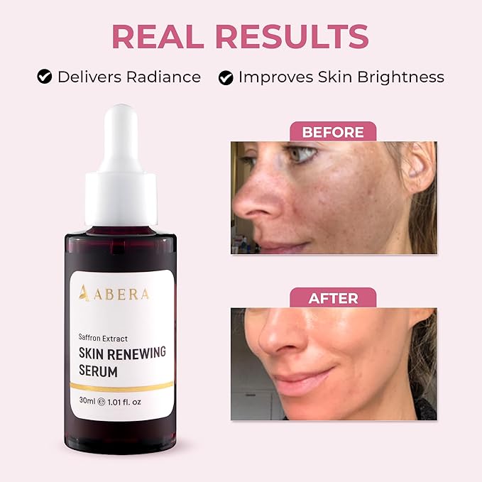 ABERA Skin Renewing Serum For Melasma Treatment, High-Potency Saffron Extract + Gift Curcumin Face Cleanser with Turmeric, Face Wash to Reduce Sebum (3 Boxes + Gift)