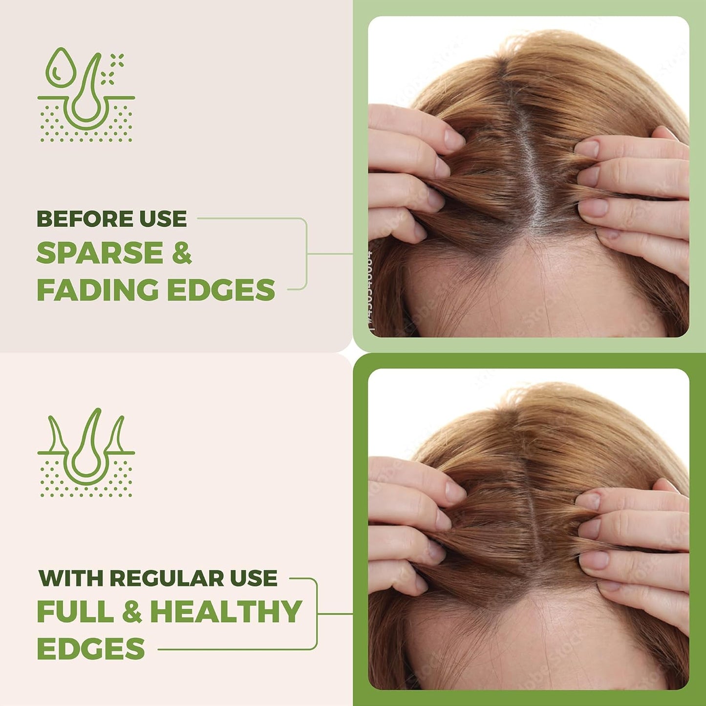 Premium Batana Oil for Hair Growth Blend -100% Natural Batana from Honduras, Castor & Rosemary Oil to Stimulate Hair Growth - Botana, Aceite De Batana - Natural Hair Products for Women & Men