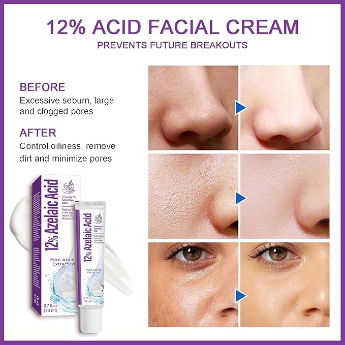 Azelaic Acid Serum 12% Azelaic Acid Cream, Azelaic Acid Facial Cream, Facial Serum with Hyaluronic Acid and Niacinamide, Redness Reducing Skin Care, Balances Excess Sebum