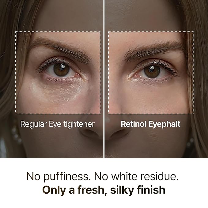 Retinol Eyebag Cream for Puffiness, Dark Circles & Fine Lines, Wrinkle, EGF Anti-Aging Under Eye Moisturizer with Niacinamide&Ceramide Makeup friendly korean skin care