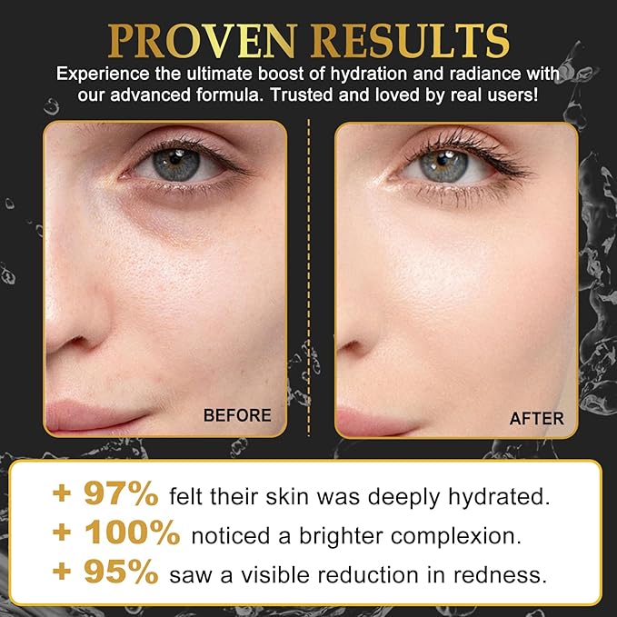 Snail Mucin Mask - Collagen Face Mask, 6 EA Face Sheet Mask with Advanced Snail Mucin Serum, Hydrating Facial Masks Skincare, Overnight Hydrogel Face Mask for Women, Korean Skin Care Glass Glow