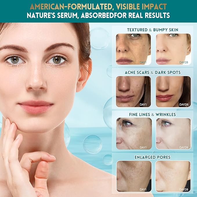 Face Serum - Anti-wrinkle Facial Serum Combat Fine Lines and Wrinkles with our Nourishing Hydrating and Moisturizing, 1.18 Fl Oz