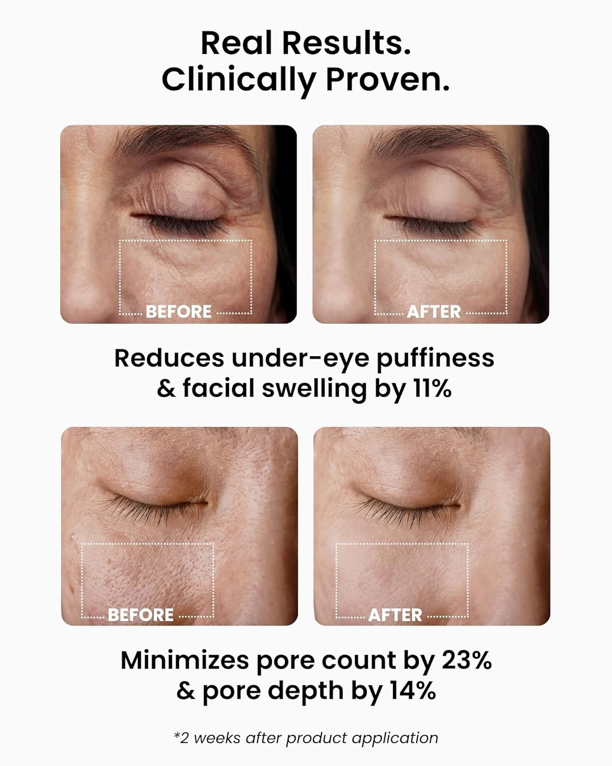 Ice Roll Serum - Cooling Serum with Face Massager Roller for Under Eye Bags, Puffiness, Dark Circles, Hydrating & Pore Minimizing with Panthenol, Tannin - Korean Skin Care, 1.69 Fl Oz (50ml)