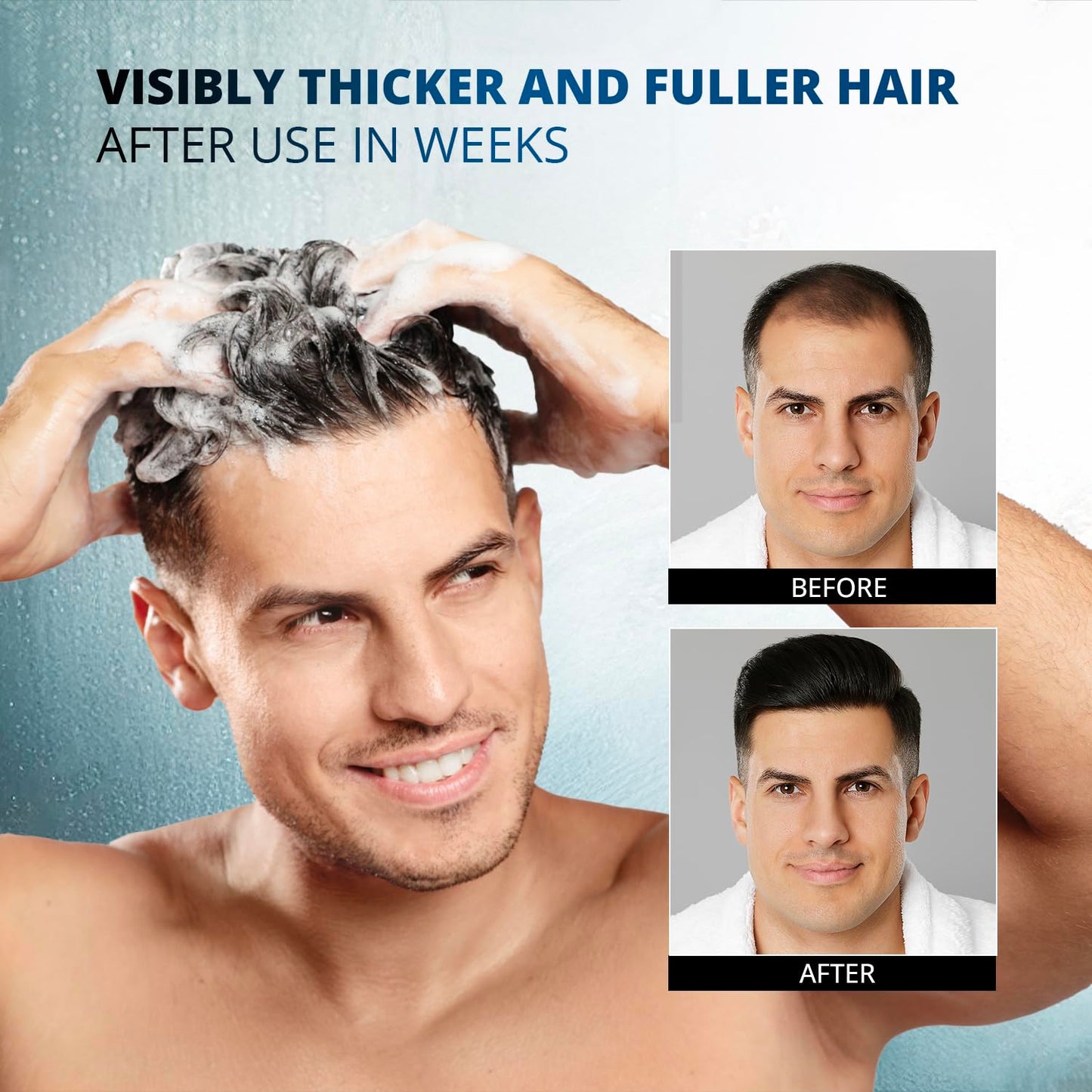 Root Activator Shampoo for Men - Hair Growth Shampoo for Hair Loss and Thinning Hair - Hair Loss RegrowthTreatments for Women Men (10.1 Fl Oz (Pack of 2))