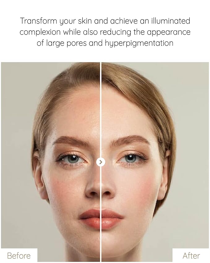 MASTINA White Mastic Ampoule Sheet Mask (4pc) Illuminating, Radiance-Boosting. Ultra-Moisturizing Facial Mask. Intensive Korean Skin Care. Fermented Mastic Gum