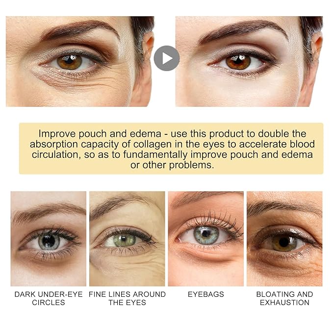 30 Pairs 24K Gold Eye Masks, Crystal Collagen Gel Eye Patches for Puffy Eyes, Reducing Fine Lines, Eye Bags, Moisturizing Cooling Skin Care Pads for Puffiness & Dark Circleseye Patches