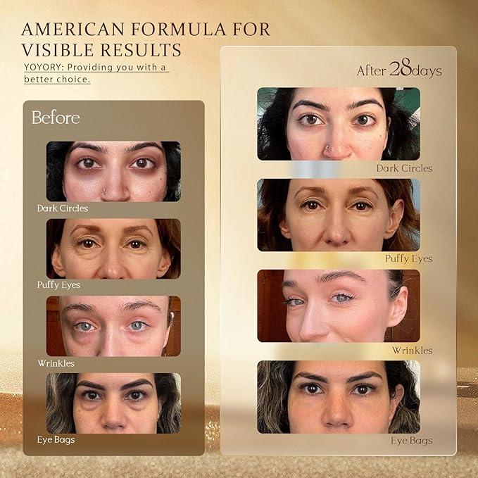 Retinol Under Eye Cream - Eye Cream for Dark Circles and Puffiness, Eye Bags, Wrinkles Fine Lines Skin Care Hydrates & Lifts Gold(0.47 Fl Oz)