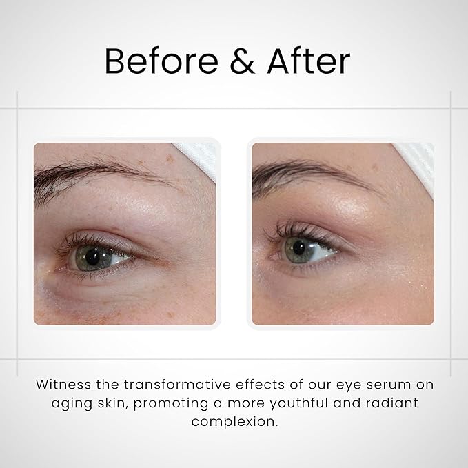 Organic Eye Oil Serum, Under Eye Brightener, Under Eye Serum for Eye Bags, Puffy Eyes Treatment, Dark Circles Under Eye Treatment, Skin Care Essential Anti-Aging Eye Oil (0.5 fl. oz / 15 ml)
