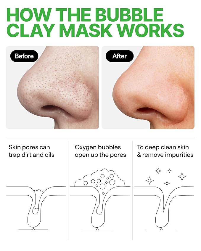 Korean Carbonated Bubble Clay Mask for Face – Black Head Remover for Face – Deep Pore Cleansing Mask – Facial Blackhead Remover – Pack 14 Korean Skincare
