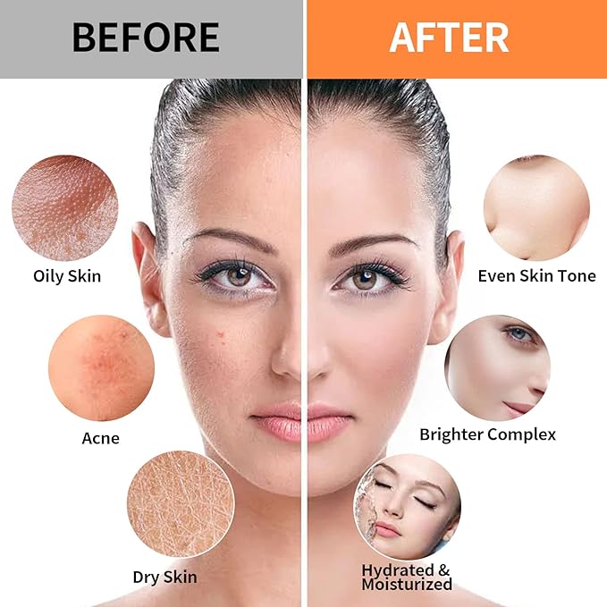 24K Gold & Hyaluronic Acid Jelly Mask, Facial Skin Care- Collagen Peel-Off Jelly Mask Set, For Facials, Face Mask For Instant Hydration, Vegan Peel Off Face Mask, For Hydration