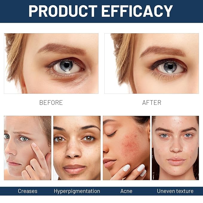 2PCS Paracress Facial Oil, Paracress Oil,Natural Paracress Extract Oil,Paracress Facial Serum Organic, Reduce Smooth Fine Lines and Wrinkles,for All Skin Types