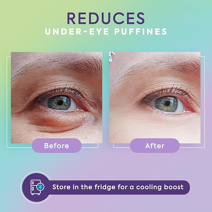 LivaClean 24k Gold Under Eye Patches (30 Pairs), Eye Mask, Collagen Skin Care Products, Eye Patches for Puffy Eyes, Eye Masks for Dark Circles and Puffiness