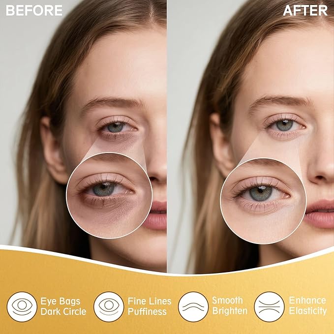 Under Eye Patches - Eye Mask for Puffy Eyes and Dark Circles, Eye Patches with Hyaluronic Acid & Collagen to Reduce Wrinkles and Relieve Pressure (20 Pairs)
