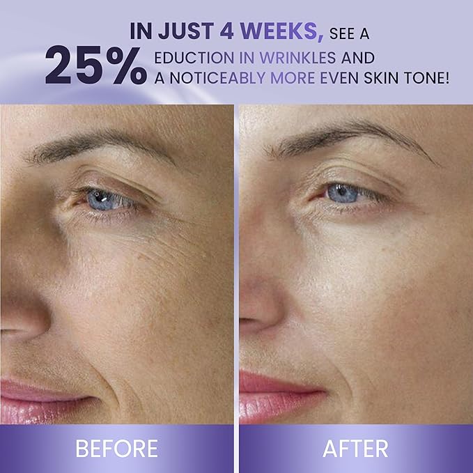 ABERA Belani Retinol Night Cream with Collagen & Hyaluronic Acid – Anti-Wrinkle, Fine Line Smoother, Even Skin Tone, Hydrating Facial Moisturizer for Women (1.01 Fl Oz)